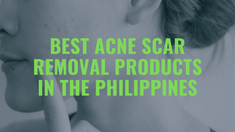Best Acne Scar Removal Products Philippines